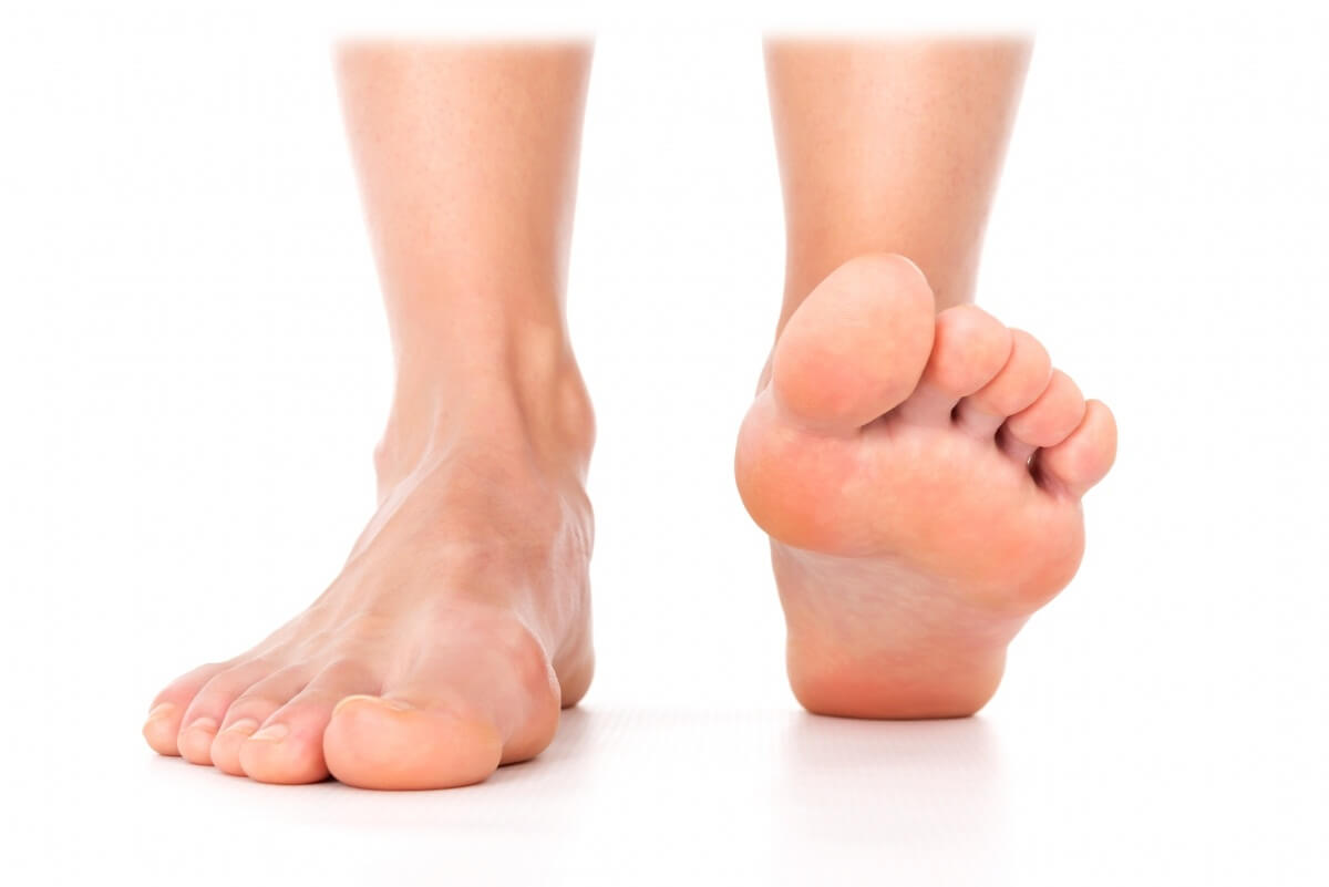 плоскостопие