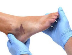 легкое растяжение