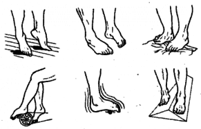 лфк после перелома