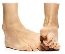 косточка на мизинце ноги