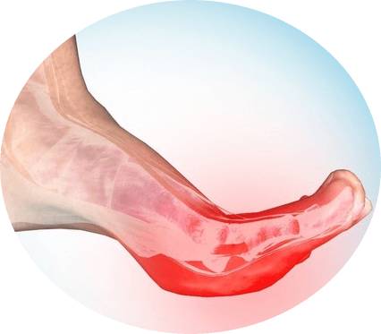 судороги с пальцах