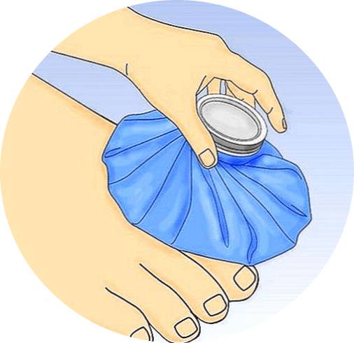 компресс на ногу