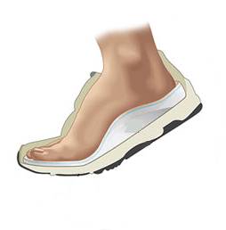 ортопедическая обувь