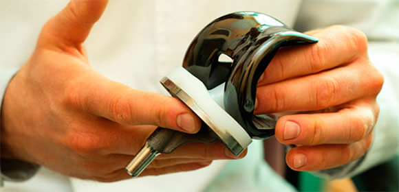 эндопротез