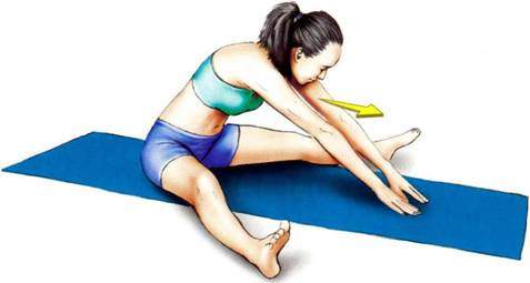 растяжка после операции