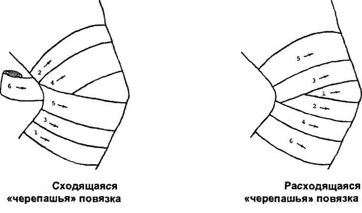 повязки