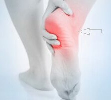 артрит пятки