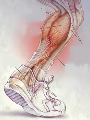 боли в голени