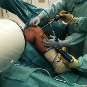 малотравматичная операция артроскопия операция