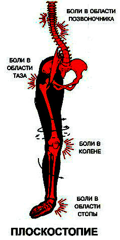 проблемы из-за стоп