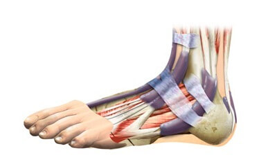 растяжение голени