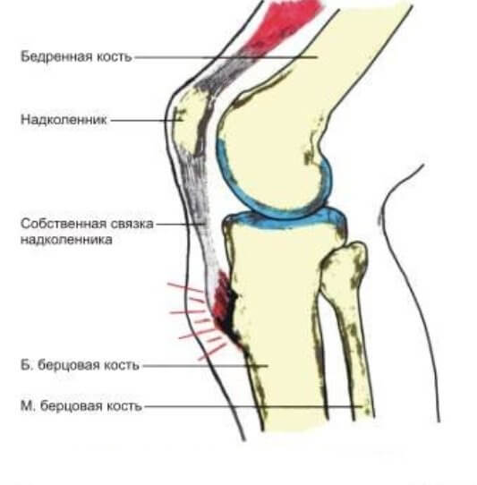 шишка под коленом