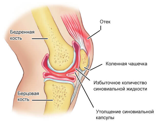 схема строения колена коленный сустав