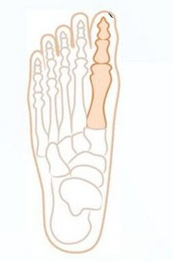 сустав большого пальца ноги