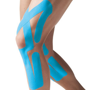 тейпирование