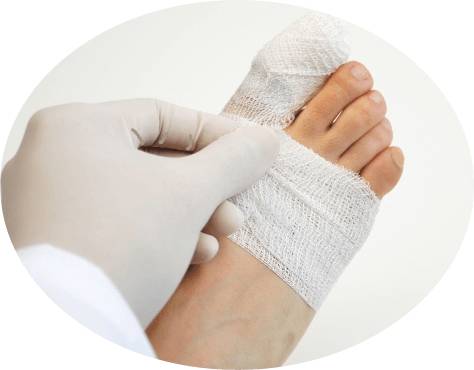 ушиб пальца ноги