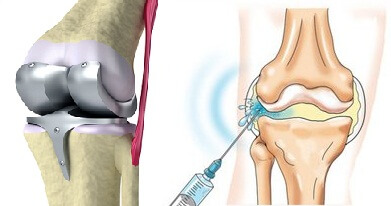 на фото изображены жидкий и обычный протез протез